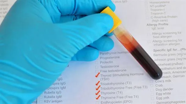  Cómo interpretar un análisis de sangre. Tatuajes y sistema inmunitario. Síndrome de boca seca