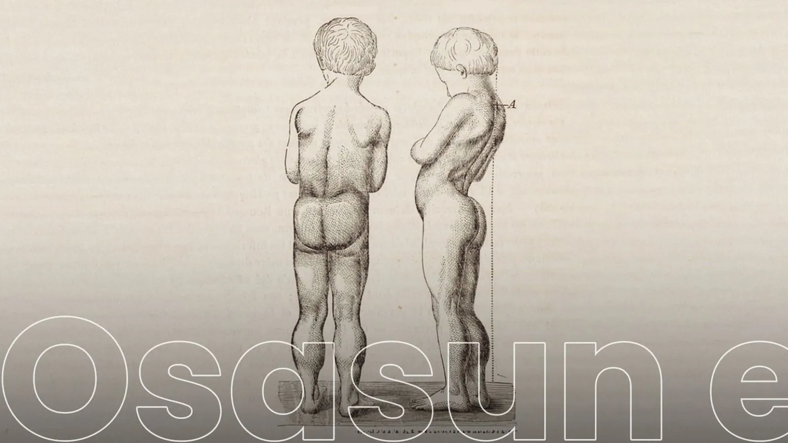 Duchenne gaisotasunaz 