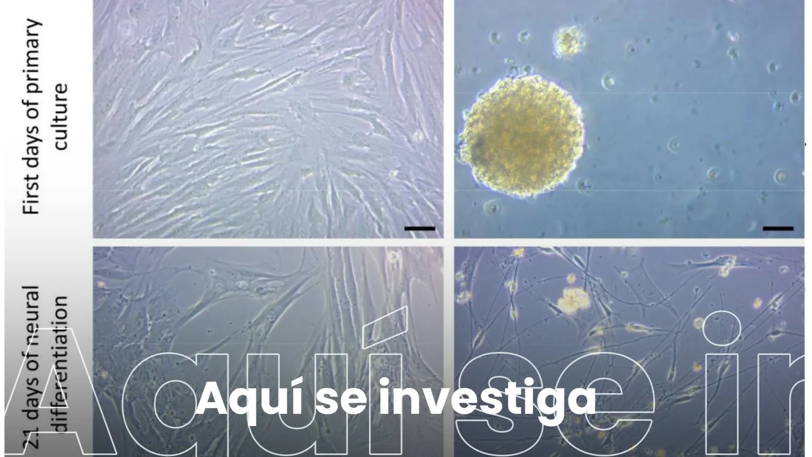 Uso de células madre de la pulpa bucal para generar células de tipo neuronal